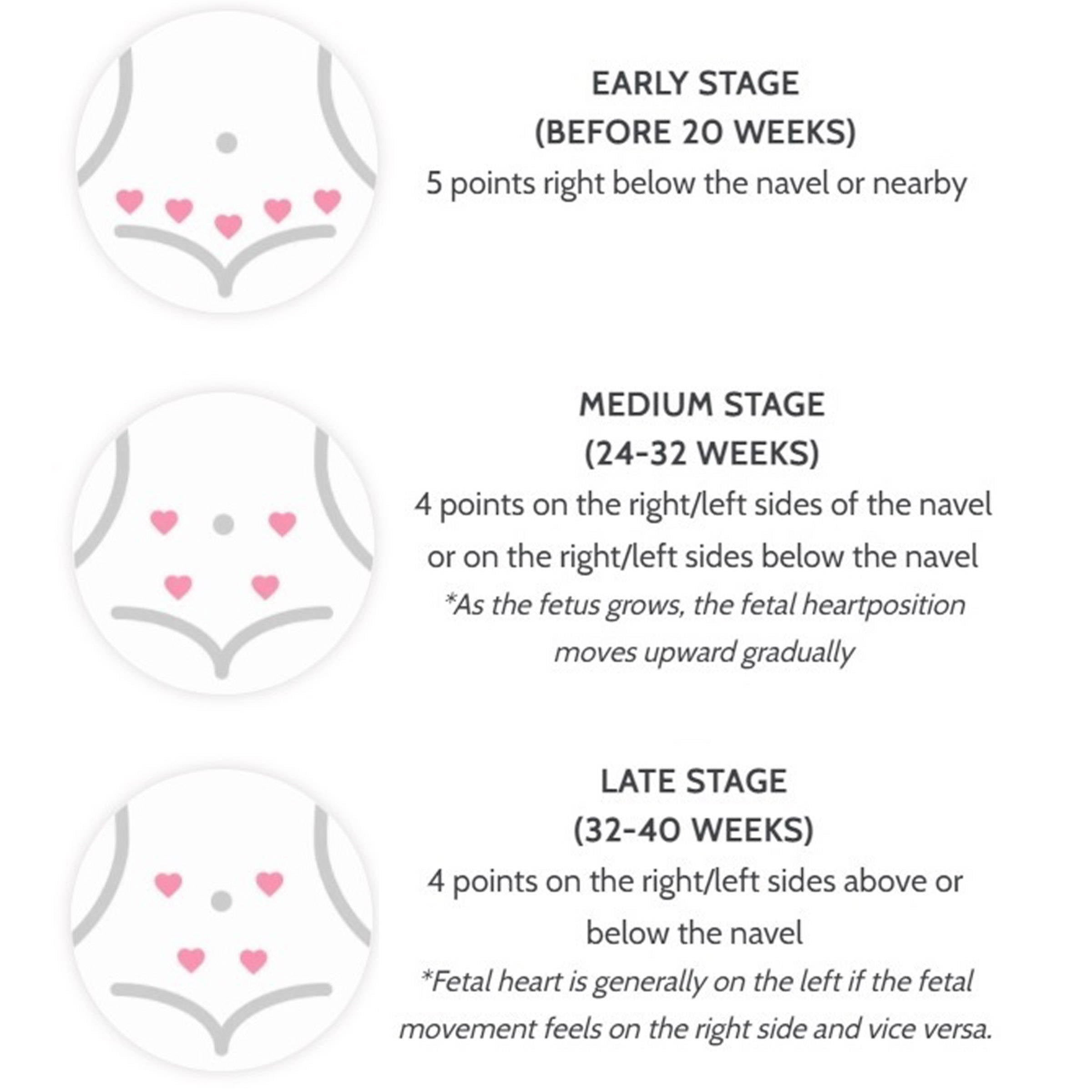 Jumper Fetal Doppler